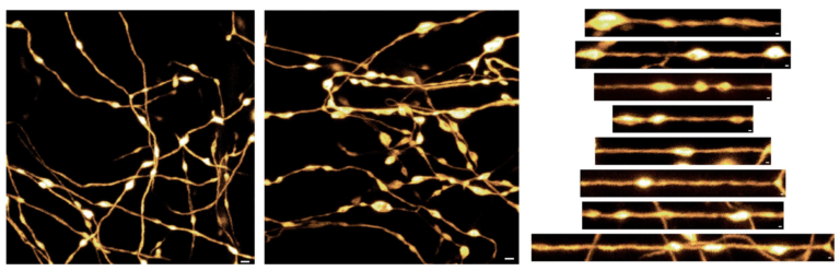 Axones de las neuronas