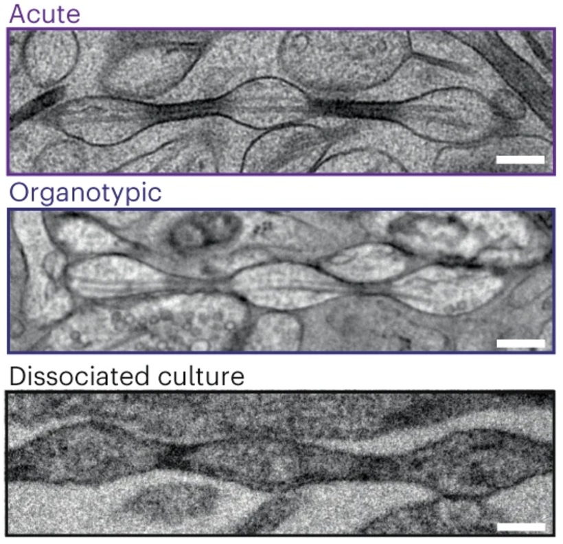 Axones de las neuronas