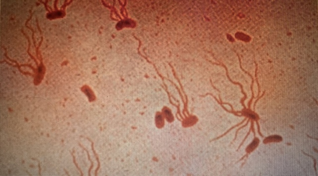 salmonella typhi picture