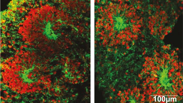 Scientists Sent Human Minibrains to Space. They Matured Faster Than Earth Brains