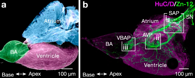 zebrafish heart 