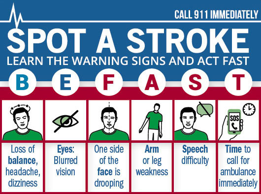 Spot Stroke