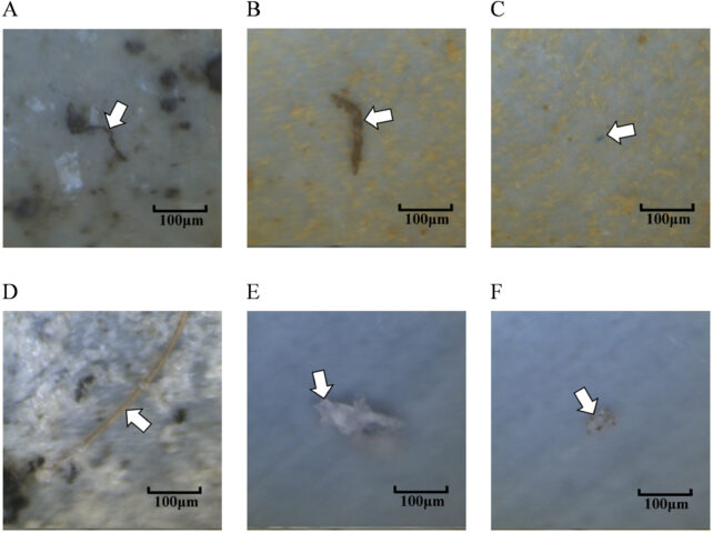 Microplastics Suspected to Motive Fertility, Intestine, And Lung Problems, Warns New Assessment