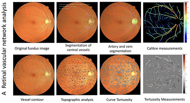 Eye scans