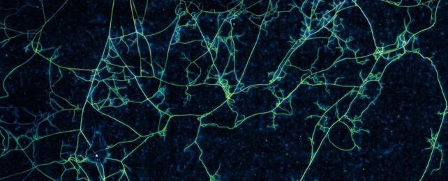 cross-section photo of underground fungal network which appears to be fluoro green, while the soil around it is black/dark blue. scene is possibly lit with UV.