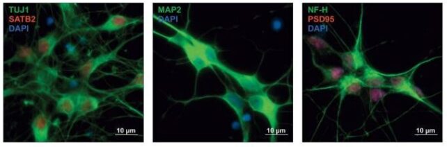 These Eight Psychiatric Disorders Have a Surprising Genetic Connection