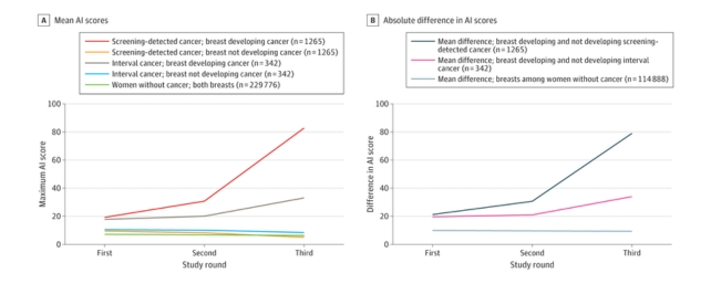 Graphic showing how well AI detected breast cancer 