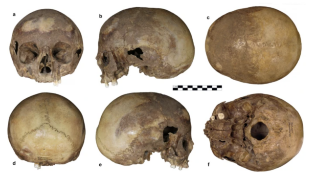 Skull Ephesus Analysis