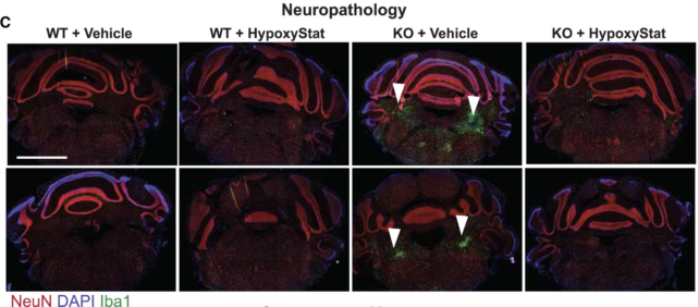 Brain Lesions Mice HypoxyStat