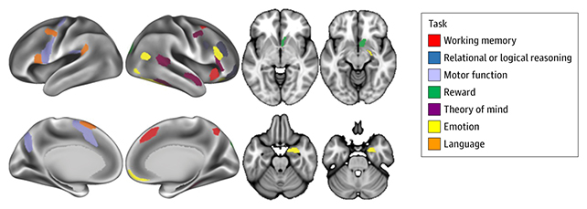 Brain scans