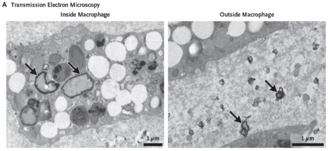 Plastics Microscopy