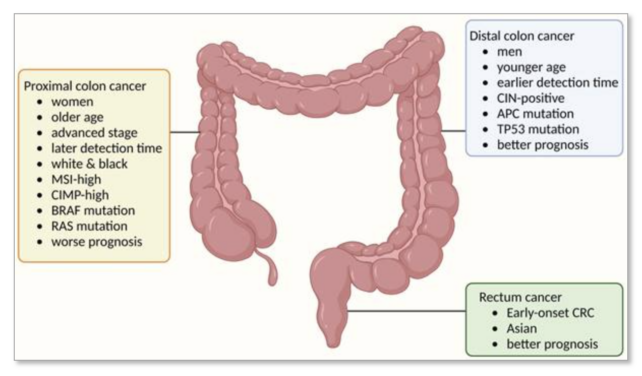 Colon Cancer Graph