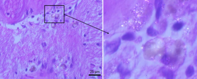 microscope image of plastic nanoparticles in brain tissue