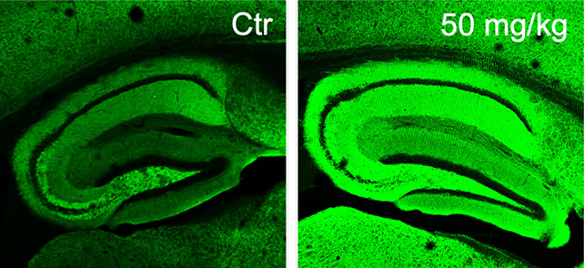 Mouse brains