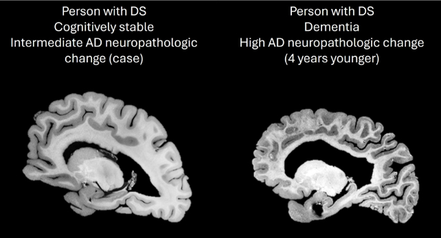 brain imaging