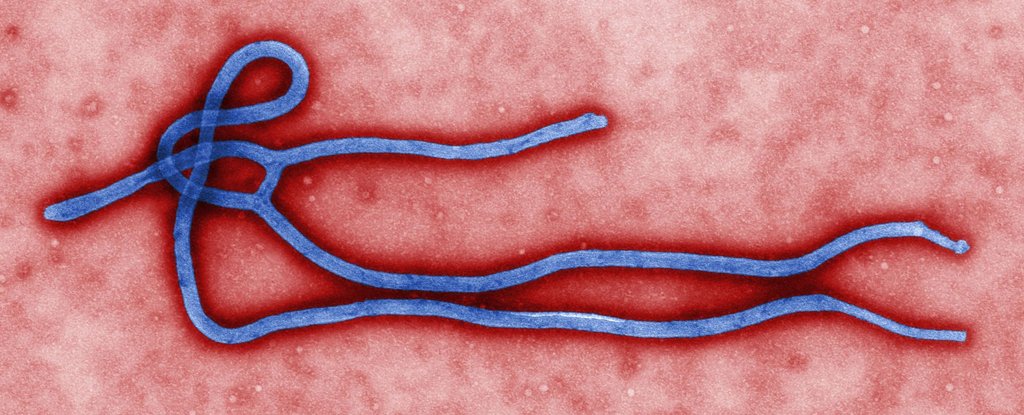 Ebola May Be Cured With a Pill, Monkey Experiment Suggests : ScienceAlert