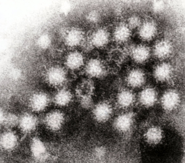 sem of norovirus particles