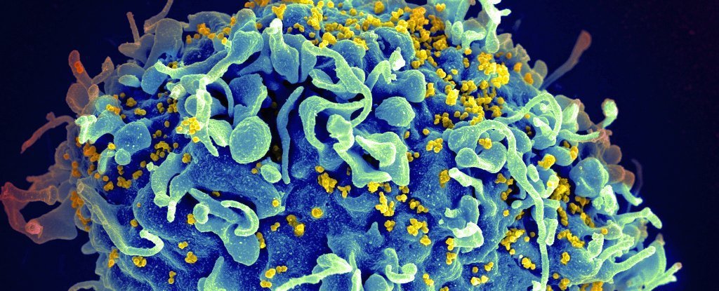 Vaginal Bacteria Have Been Found to Neutralise HIV Treatment