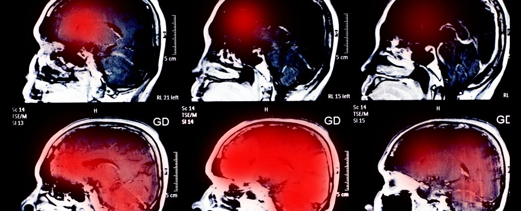 scientists-find-that-bigger-brains-aren-t-necessarily-smarter