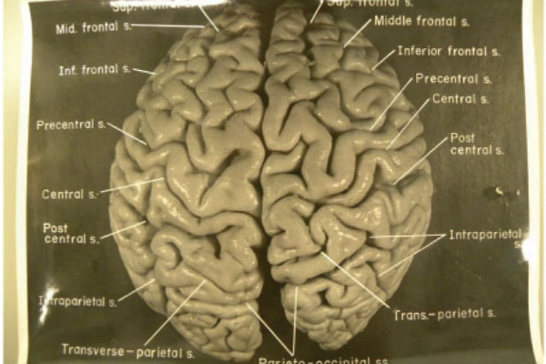 New study reveals there was nothing special about Einstein ... diagram of violin parts 